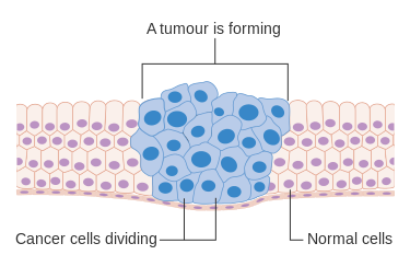 Diagram Showing How Cancer Cells Keep On Reproducing To Form A Tumour Cruk 127 Svg