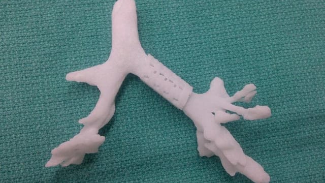 What happens when you don’t print safely – a windpipe that won’t leave you breathless