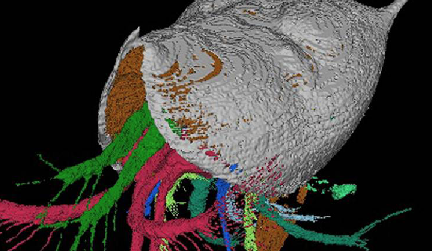 Imperial Scientists create model of extinct lung parasite
