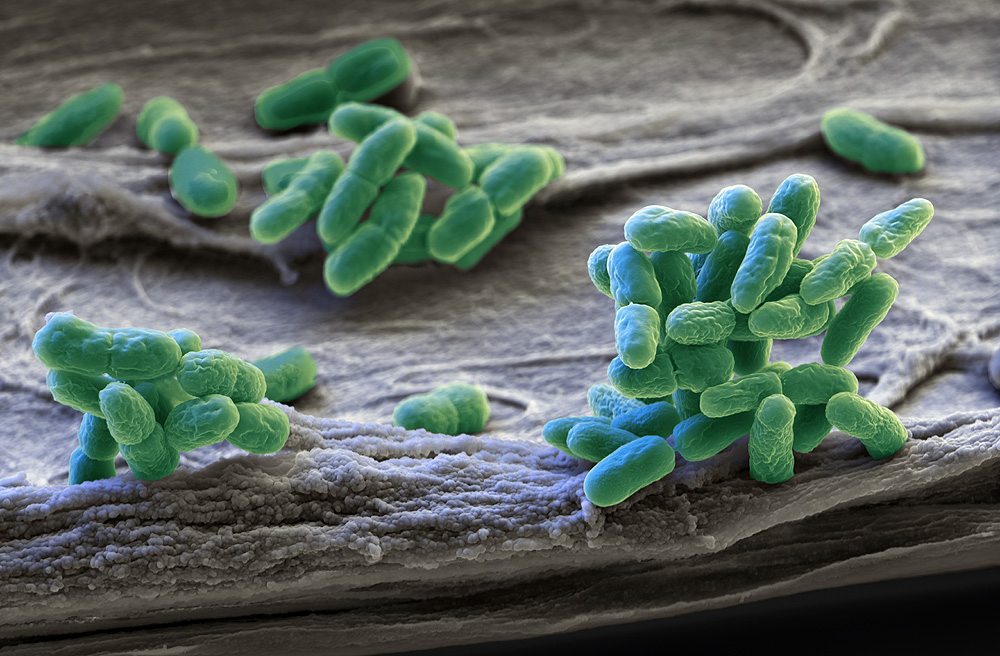 A fresh look through bacteria
