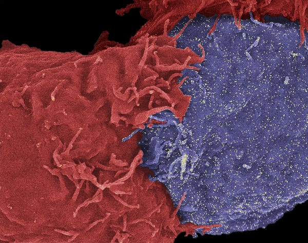 Roche developing new technology for cancer immune therapies