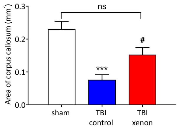 Xenon could be used to reduce traumatic brain damage, Imperial study finds