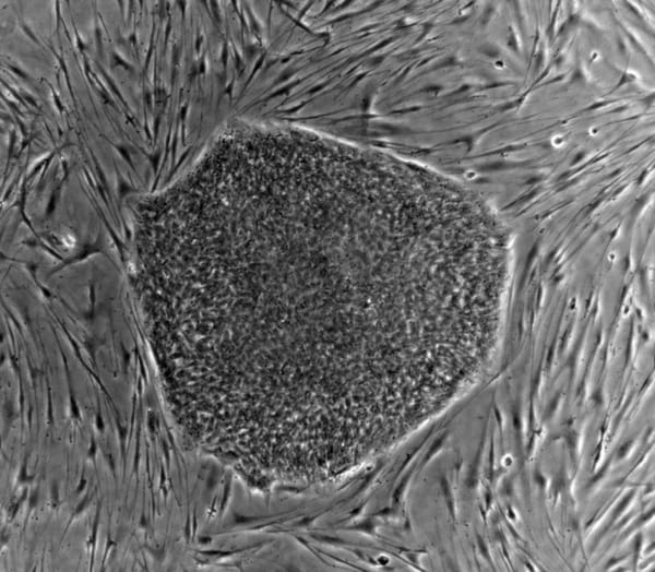 Stem cells aid recovery from stroke
