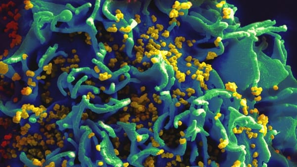 Breakthrough in HIV gene therapy
