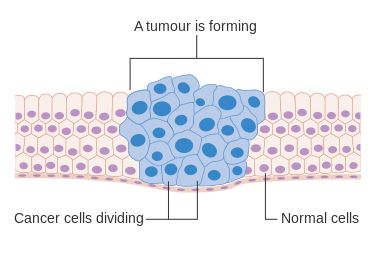Diagram Showing How Cancer Cells Keep On Reproducing To Form A Tumour Cruk 127 Svg