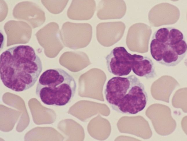 Virus Induced Leukaemia Cells Credit Dr Kumamoto Utsonomiya